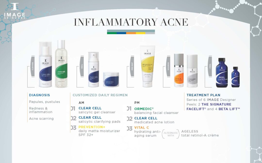 Inflammatory Acne Regimen