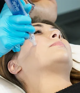 skinpen microneedling treatment