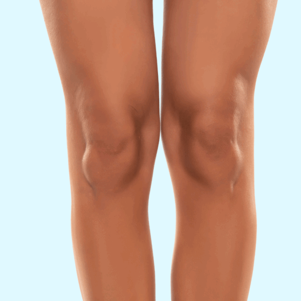 CoolSculpting Elite (Above the Knee Package)
