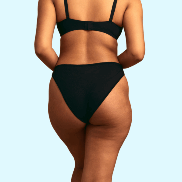 CoolSculpting Elite (Banana Roll Package)