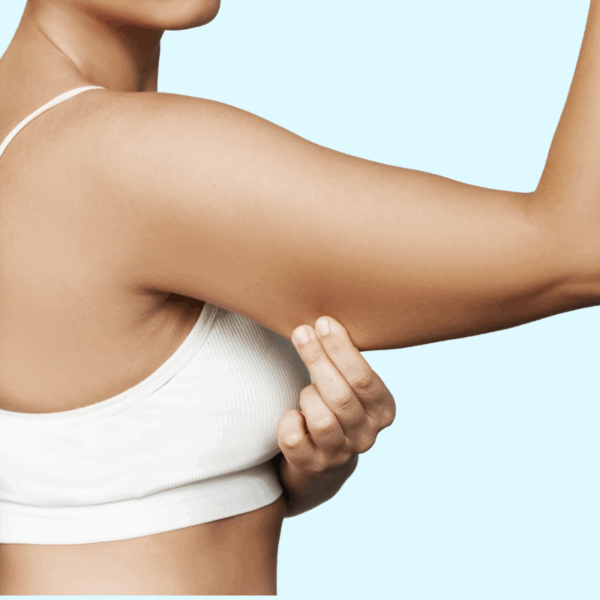 CoolSculpting Elite (Arms Package)