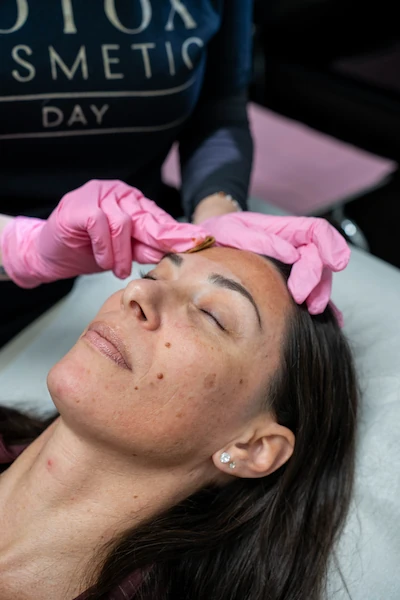 Patient receiving VI Peel at Mystique MedSpa