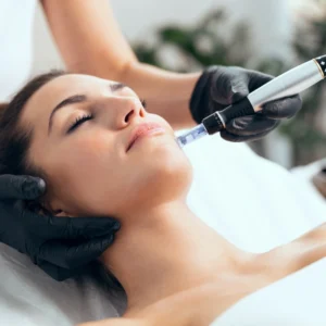 SkinPen® Microneedling