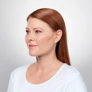 Kybella Chin Contouring